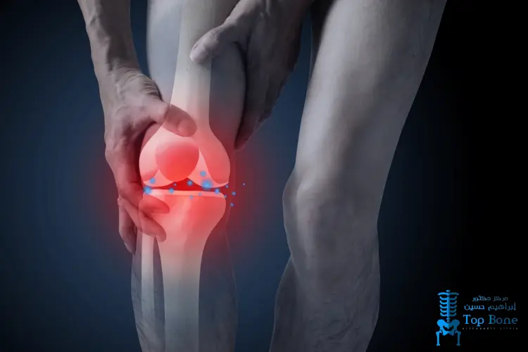 أفضل طرق علاج تاكل غضاريف الركبة وأحدث التقنيات الطبية