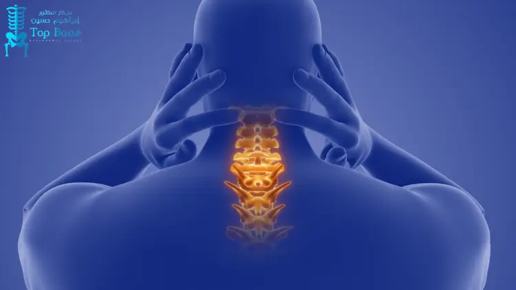 علاج تاكل غضاريف الرقبة: الأسباب والأعراض وأفضل طرق العلاج