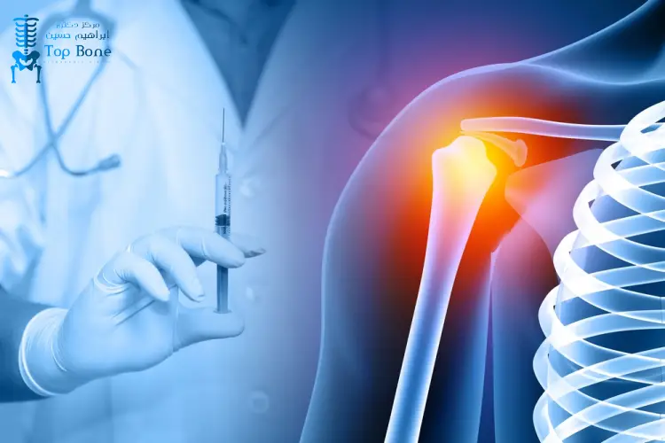 سعر حقن البلازما للكتف في مصر 2026 | الاعراض وطرق العلاج