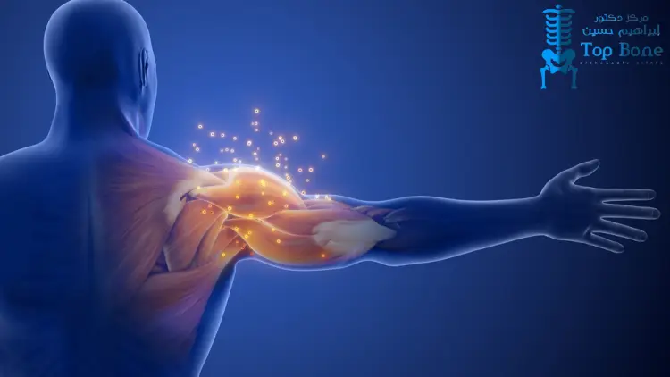 علاج الكتف المتجمد نهائيًا: الأسباب والأعراض وأفضل طرق العلاج