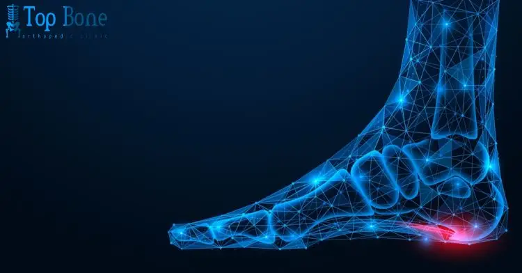 تجربتي مع الشوكة العظمية: الأعراض وطرق العلاج الفعالة