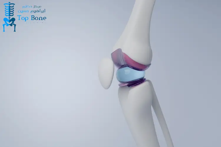 التهاب الغشاء السينوفي: الأسباب والأعراض وطرق العلاج الفعالة