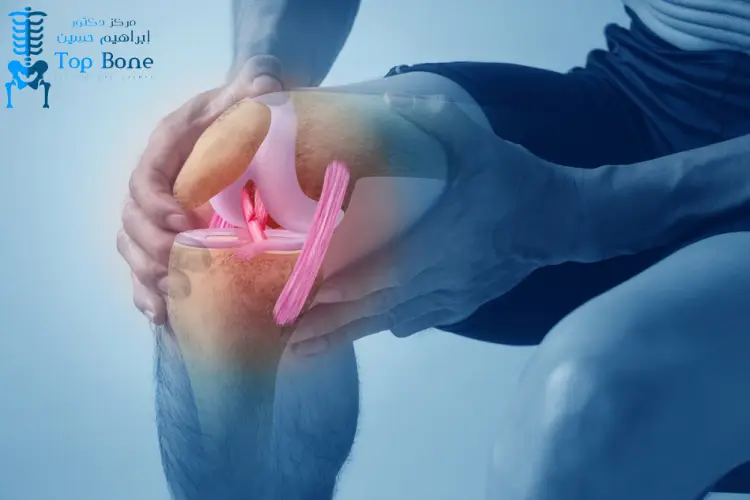 تكلفة عملية الرباط الصليبي بالمنظار في مصر 2026