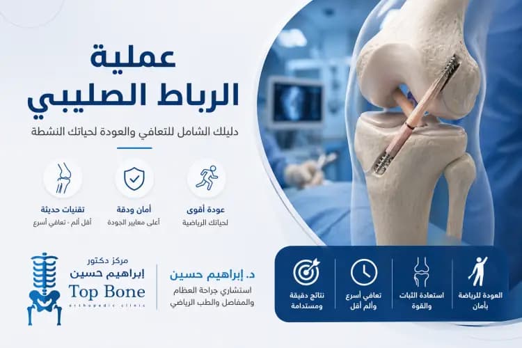 عملية الرباط الصليبي 2026: متى تكون الجراحة هي الحل الوحيد؟