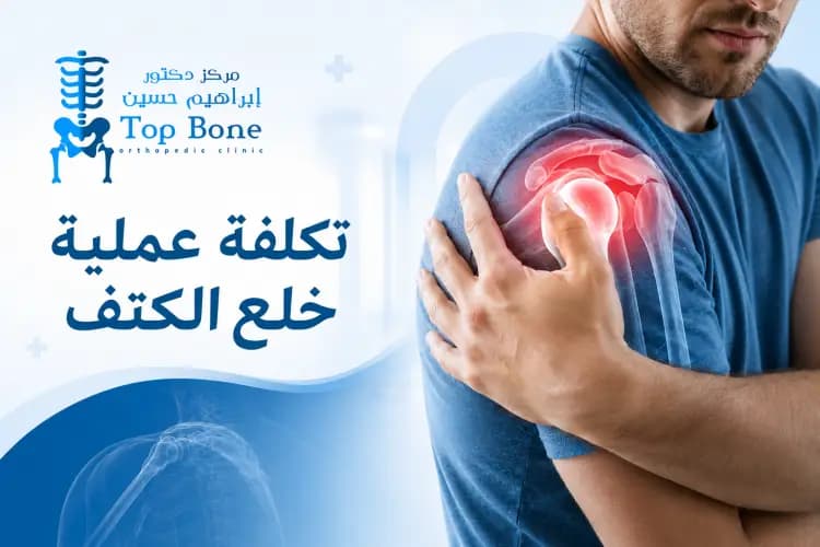 ماهي تكلفة عملية خلع الكتف في مصر 2026