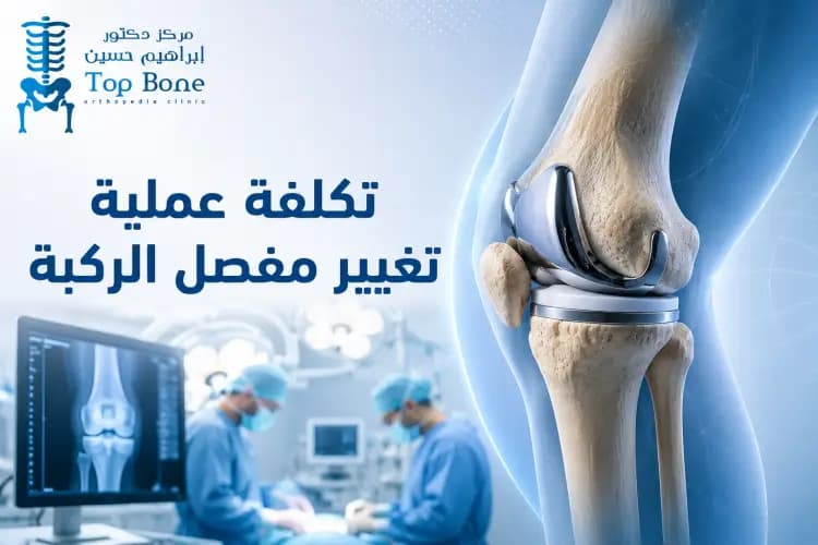 تكلفة عملية تغيير مفصل الركبة في مصر: الدليل الطبي والأسعار