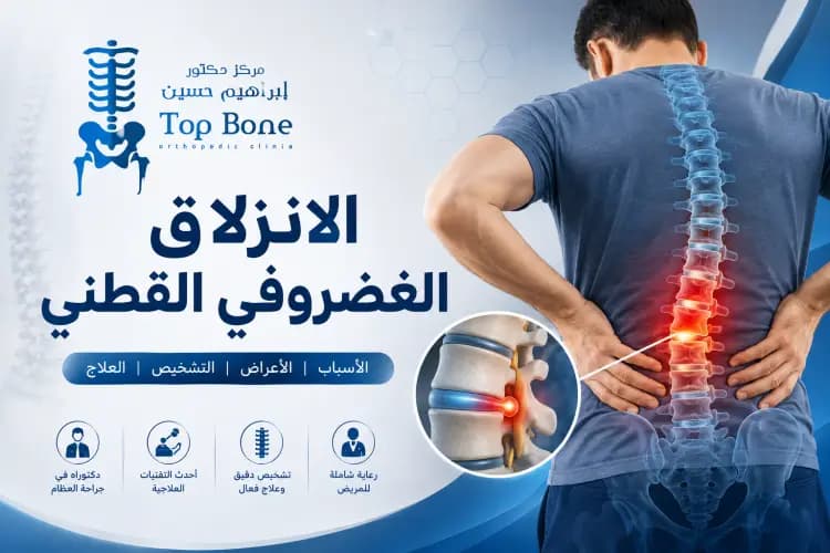 هل الانزلاق الغضروفي القطني خطير