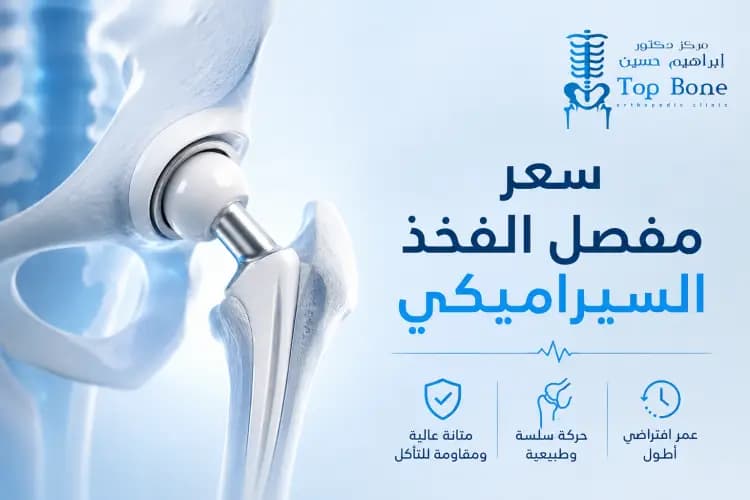 سعر مفصل الفخذ السيراميكي وأهم العوامل المؤثرة على تكلفته
