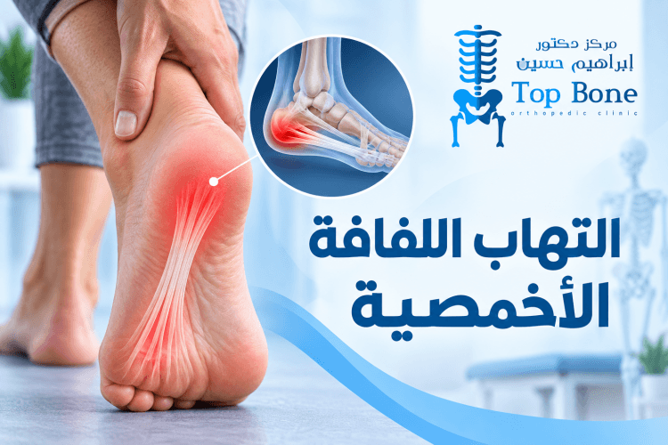 التهاب اللفافة الأخمصية الأسباب والأعراض وطرق العلاج الفعالة
