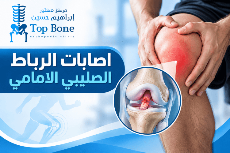 اصابات الرباط الصليبي الامامي: الأسباب، والأعراض وطرق العلاج