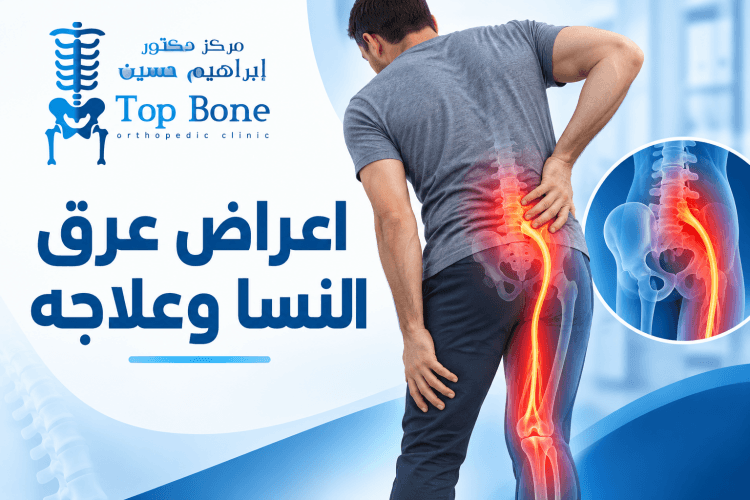 اعراض عرق النسا وعلاجه: الأسباب وطرق التشخيص والعلاج المتاحة