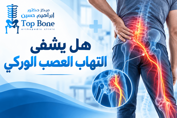 هل يشفى التهاب العصب الوركي؟ أفضل طرق العلاج ونصائح للتعافي