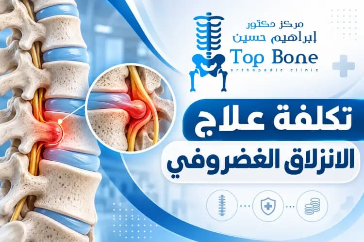 تكلفة علاج الانزلاق الغضروفي في مصر وأهم العوامل المؤثرة بها