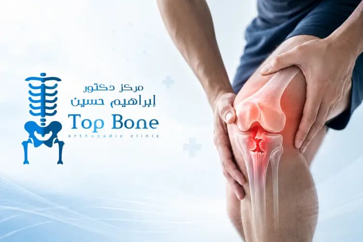 قطع وتر الركبة