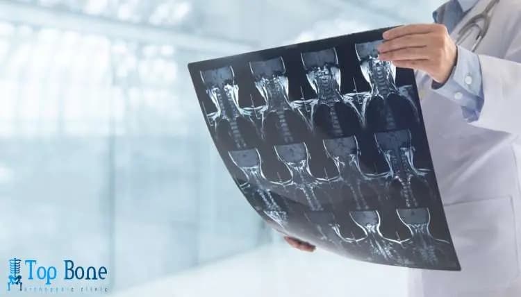 أفضل دكتور تخصص ركبة في مصر 2026 | مناظير وجراحة حديثة