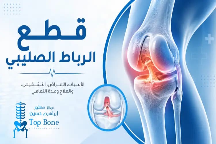 قطع الرباط الصليبي: الأعراض، والفرق بين القطع الجزئي والكلي