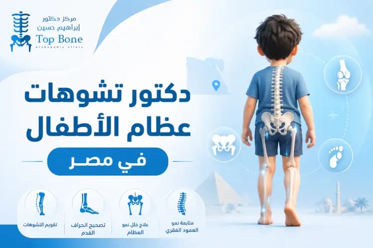 افضل دكتور تشوهات عظام اطفال في مصر 2026