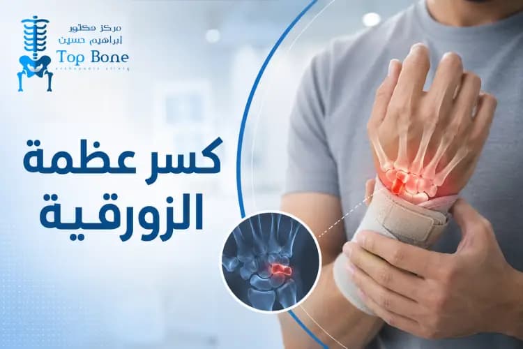 كسر عظمة الزورقية: الأعراض والأسباب وطرق العلاج الشامل لليد