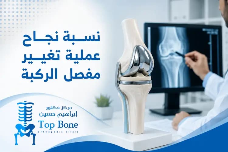 نسبة نجاح عملية تغيير مفصل الركبة وأهم العوامل المؤثرة عليها