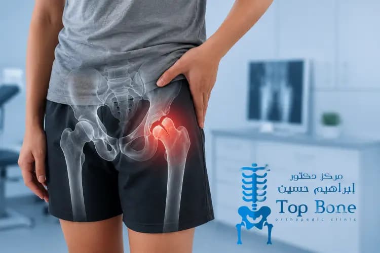 انزلاق رأس عظمة الفخذ
