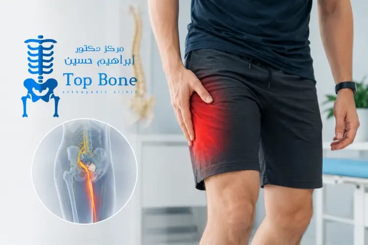 ألم الفخذ المذلي